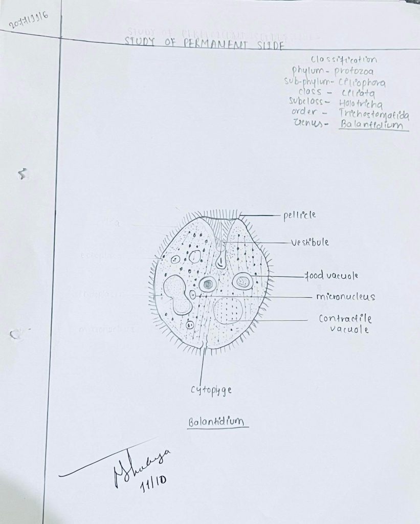 Study of permanent slide Balantidium(Protozoa)