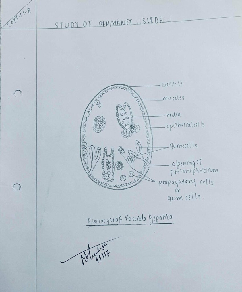 sporocyst of Fasicola Hepatica